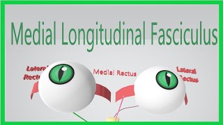 Medial Longitudinal Fasciculus Made Ridiculously Simple [upl. by Leirea]