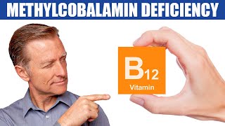 The 1st Sign of a Methylcobalamin B12 Deficiency [upl. by Seedman]