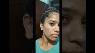 25 days complete tretinoin cream 0025 tretinoincream face tretinoin [upl. by Osric]