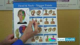 Trigger Point Chart  Color Coded Research Based Treatment Plans  Kent Flip Chart [upl. by Licastro]