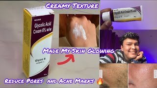 Glyco 6 cream  Glycolic 6 Cream Review In Hindi  Honest Review [upl. by Akinal]