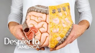 Síntomas del cáncer de colon y cómo prevenirlo [upl. by Amikat43]