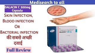 Dalacin C 300mg Capsule  Skin infection or Bacterial infection की सबसे अच्छी दवाई  How To Take [upl. by Joaquin]