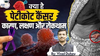 What Is Petticoat Cancer Causes Symptoms And Prevention  By Virad Dubey  Study IQ IAS Hindi [upl. by Divadnoj]