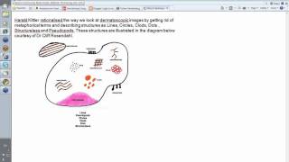 Dermoscopy Made Simple  Kittlerian Terminology [upl. by Laro]