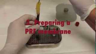 Platelet Rich Fibrin PRF  A short introductory Video [upl. by Niwdog]