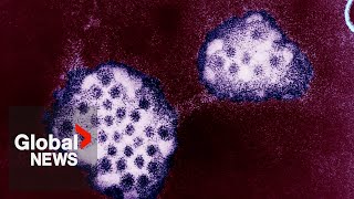 Norovirus Cases are spiking in the US but what about Canada [upl. by Tnomel]