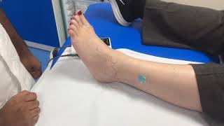 How to check for the peroneal artery pulse with a Doppler [upl. by Caterina]