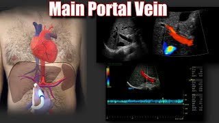 Portal Vein Doppler Protocol [upl. by Gunther]