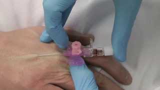 Cannulation How to gain IV access [upl. by Amjan]