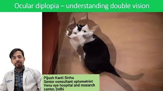 Ocular diplopia  understanding double vision [upl. by Lowis]