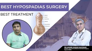 HYPOSPADIAS Surgery in Kolkata  Best Age for Hypospadias Surgery  Myths and Facts [upl. by Chloette273]