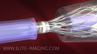 Heart Valve Catheter Loading  Medical amp Scientific Video Production [upl. by Ace]