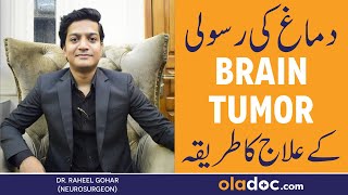 BRAIN TUMOR Symptoms And Treatment  Dimagh Ki Rasoli Kya Hoti Hai  Brain Tumor Ka Ilaj Kya Hai [upl. by Hose]