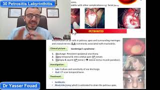 30 petrositis and Labyrinthitis [upl. by Dorina]