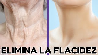 ELIMINAR ARRUGAS Y FLACIDEZ EN EL CUELLO ✨ Ejercicios para un Cuello Joven y Firme [upl. by Cyprio478]