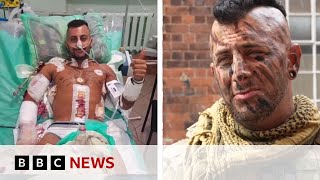 British soldier returns to Ukraine after lifechanging injury  BBC News [upl. by Damian]