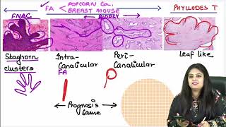 Pathology RR Part 1  DrPreeti Sharma  FMGE amp NEETPG [upl. by Corrine]