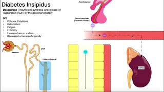 Diabetes Insipidus  Mechanism amp SignsSymptoms [upl. by Sirap335]