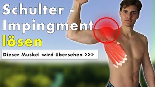 Schulterimpingement geht nicht weg  Dieser Muskel ist die Ursache  Übung [upl. by Suzetta]