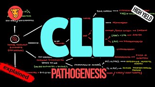 CHRONIC LYMPHOCYTIC LEUKEMIA Pathogenesis CLL Criteria Diagnosis Treatment [upl. by Ahsenom935]