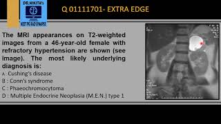 PHEOCHROMOCYTOMA MRI [upl. by Hannibal]