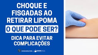 Choque e fisgadas ao retirar lipoma O QUE PODE SER Dicas para evitar complicações [upl. by Hadlee807]