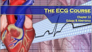 The ECG Course  Ectopy amp Aberrancy [upl. by Rempe996]