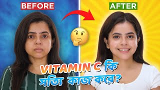 Vitamin C কি সত্যি কাজ করে  Best Vitamin C Serum for face  Wonder Munna Unplugged [upl. by Elayor]