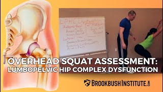 Overhead Squat Assessment Lumbopelvic Hip Complex Dysfunction [upl. by Kartis]