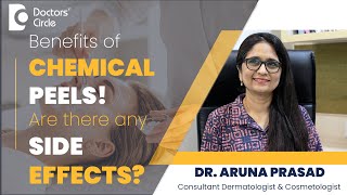 Chemical Peels For Acne Scar  Side Effects Of Chemical Peels skin DrAruna PrasadDoctors Circle [upl. by Christal274]