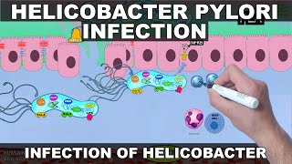 Helicobacter Pylori Pathogenesis  Detailed [upl. by Genevra285]