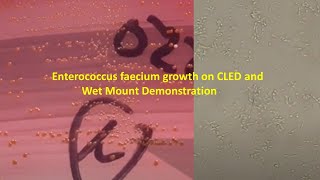 Enterococcus faecium Colony Morphology and Microscopy [upl. by Adnirolc680]