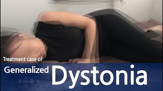 Generalized Dystonia  Abdominal dystonia  Immediate response within first treatment  전신 사경증 [upl. by Stanly]