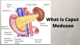 What is Caput Medusae [upl. by Isbel]