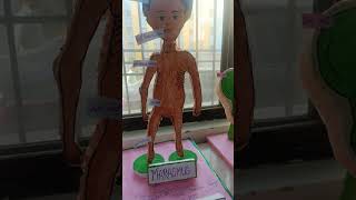 Kwashiorkor and marasmus model project [upl. by Dicks]