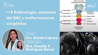 Embriología anatomía del SNC y malformaciones congénitas por la Dra Natalia Cabrera [upl. by Maidie]