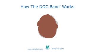 How The DOC Band® Works [upl. by Drogin]