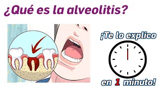 45 ¿Qué es la alveolitis  ¡Te lo Explico en Un Minuto [upl. by Desirea]