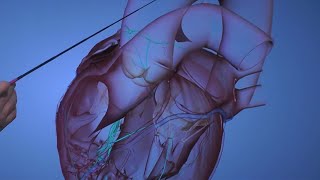 Overview of Fusiform Aneurysm [upl. by Roxanne678]