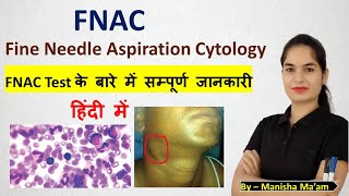 Fine Needle Aspiration Cytology  FNAC Test in hindi  FNAC test kya hota hai  FNAC test procedure [upl. by Ahcrop]