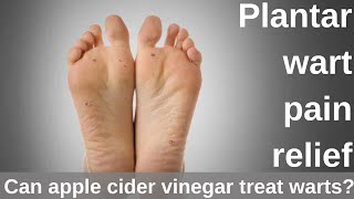 Plantar wart pain relief  Can apple cider vinegar treat warts [upl. by Gothar]