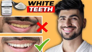 How to Whiten Teeth at Home  Teeth Whitening  Yellow teeth  Flossing  Oral Hygiene  Sahil Gera [upl. by Anitsirhk241]