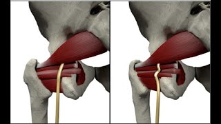 Sciatic Nerve Dynamic Ultrasound  Includes Obturator Gemellus Piriformis Quadratus Femoris [upl. by Retniw]