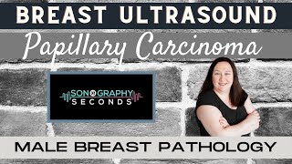 Breast Ultrasound Male Breast Pathology Papillary Carcinoma [upl. by Wesa50]