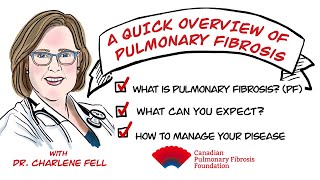 So Youve Been Diagnosed with Pulmonary FibrosisWhats Next [upl. by Piero913]