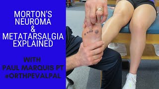 Mortons Neuroma and Metatarsalgia Whats the Difference [upl. by Eneleahcim]