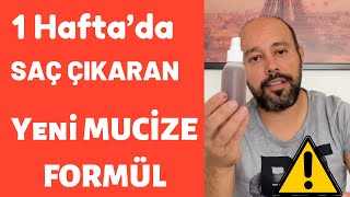 Saçlarım Yeniden Çıktı  Saç Çıkaran Mucize Doğal Kür [upl. by Liman]