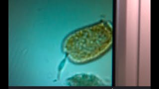 Tank Troubles Diatoms or Dinoflagellates Taking Over [upl. by Agle]