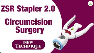 ZSR Stapler 20 A New Technique of Circumcision Surgery  Care Well Medical Centre [upl. by Sabanrab]